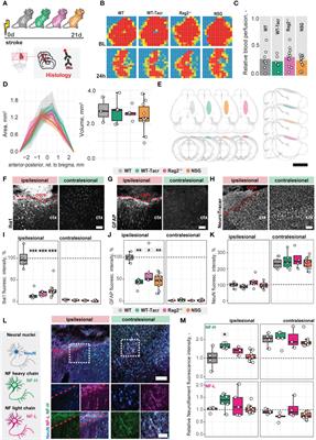 Molecular and anatomical roadmap of stroke pathology in immunodeficient mice